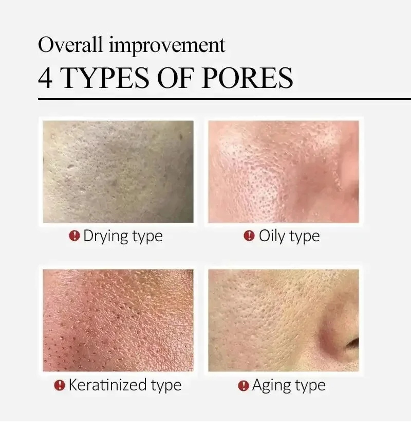 Centella Asiatica Shrink Pores - Luxury Skincare Korea recension och pris